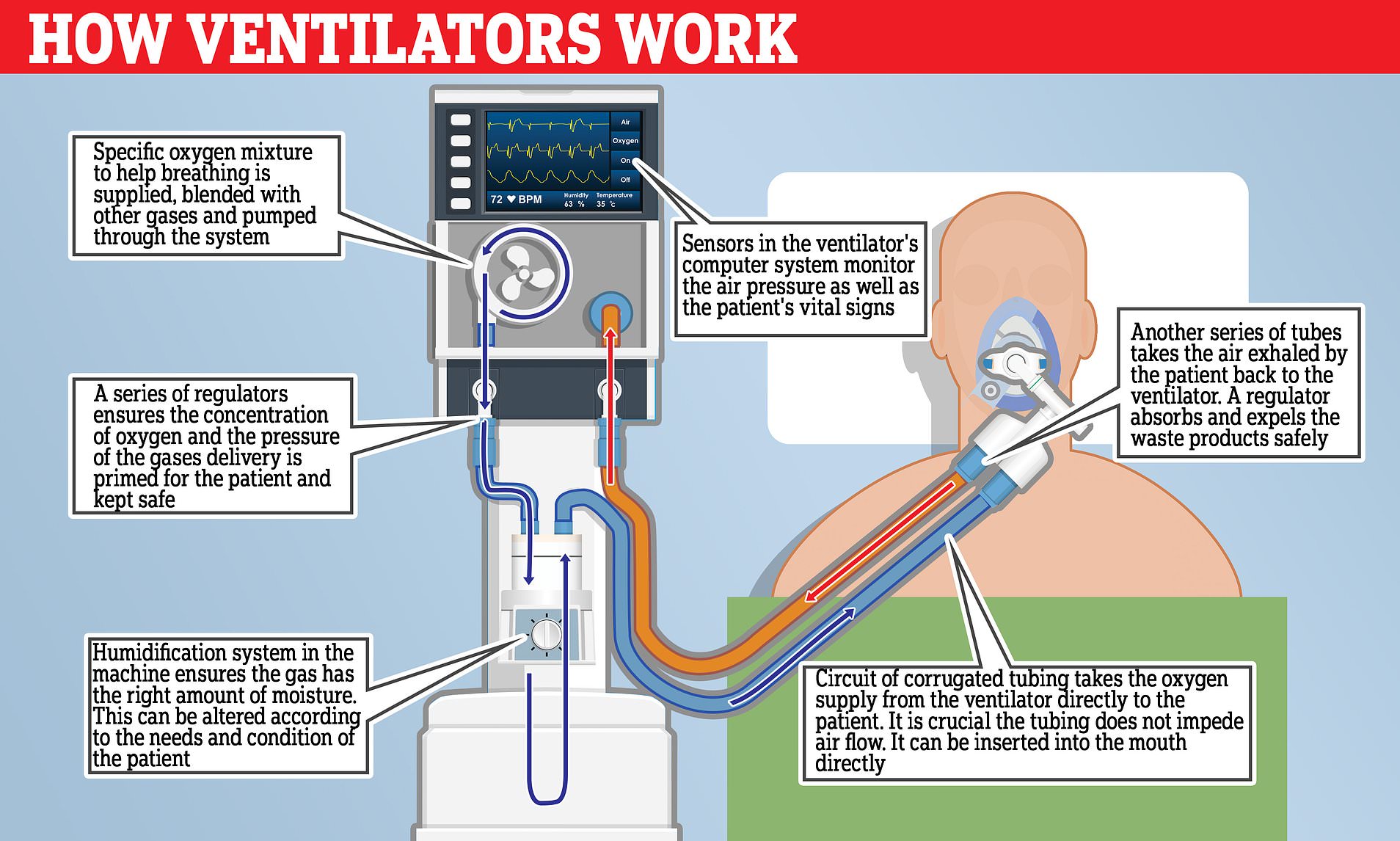 How Ventillators work