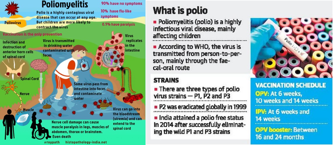 Polio Can Be Prevented By Vaccination | National Public Health Centre under  the Ministry of Health